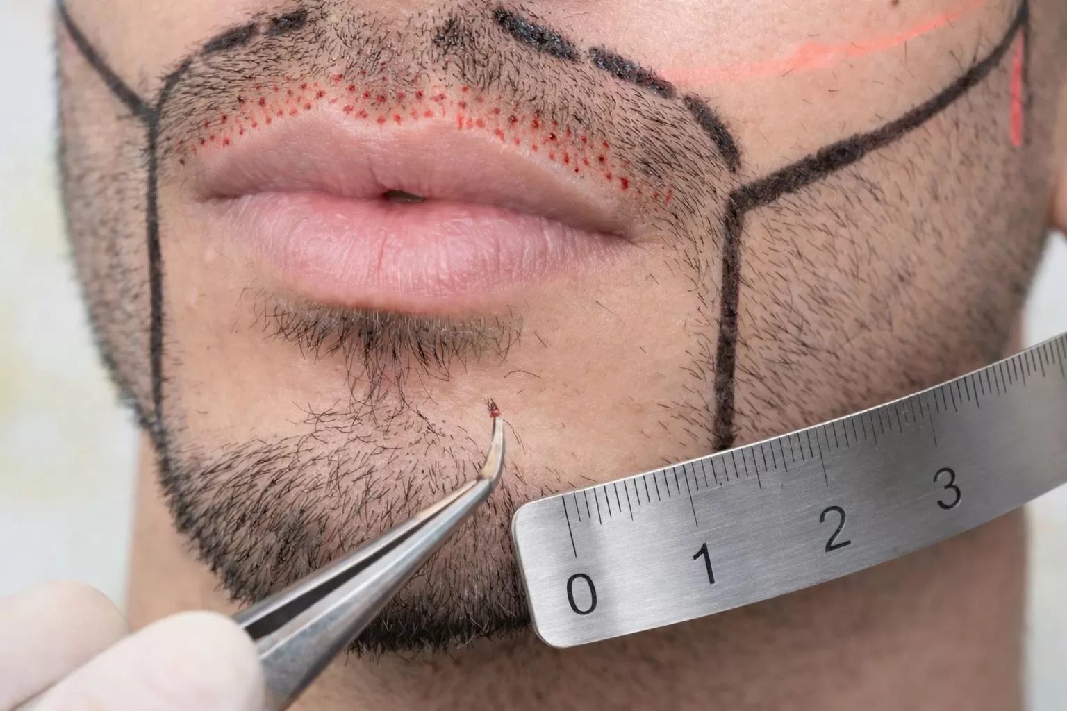 Özmen Bıyık Ekimi